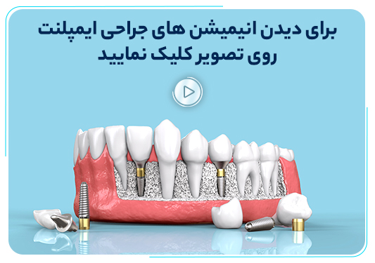 کیمیا کاشت اطبا — تصویر 8